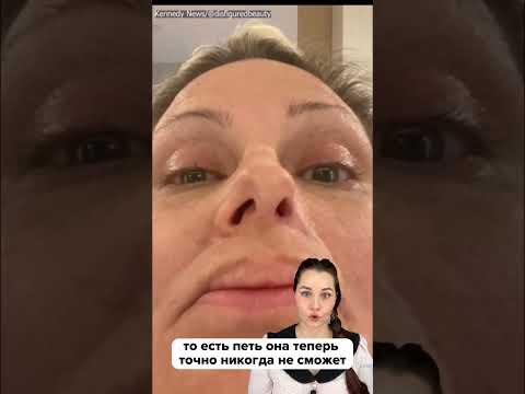 Из-за филлера лишилась профессии… и ноздри 🔞