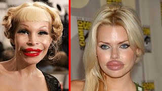 Celebrity Plastic Surgeons Who Need To Be Stopped