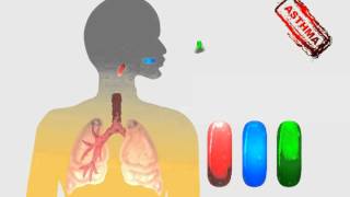 TIP 58   Chest Area   Breathing Difficulties   Wheezing