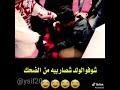 ما فائده الشعر تحت الابط شوفوا شيكله 