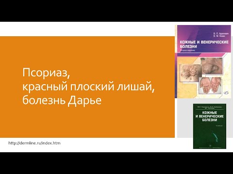 Видео: Псориазис срещу Лихен Планус: Каква е разликата?