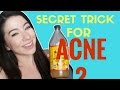 How to get rid of acne  marisa lablue