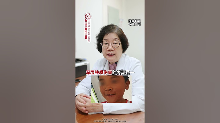 孩子不是多晒太阳才好，听听医生的真心话 #晒伤  #晒黑  #儿童防晒霜  #皮肤  #防晒