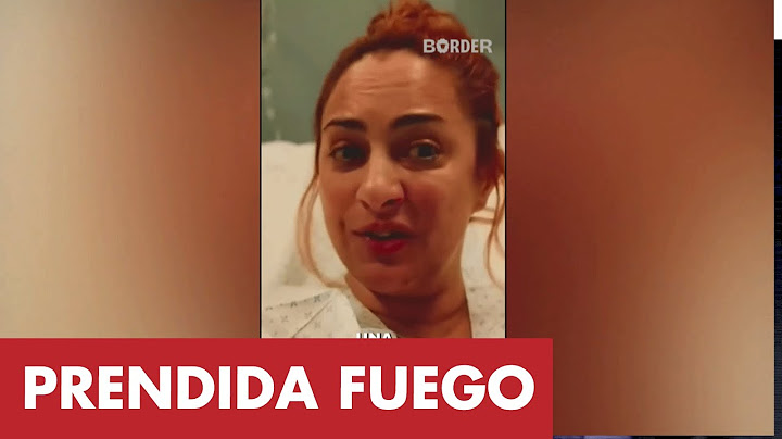 María Julia Oliván relató el impactante accidente que la dejó internada: “Me prendí fuego”