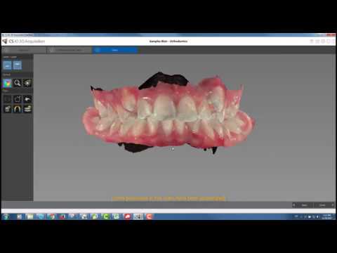 Carestream 3600 and Integration with CS Orthodontic Imaging Software