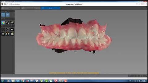 Carestream 3600 and Integration with CS Orthodontic Imaging Software