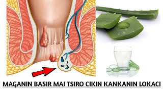 MAGANIN BASIR MAI TSIRO KO FITAR BAYA CIKIN SAUKI FISABILILLAH