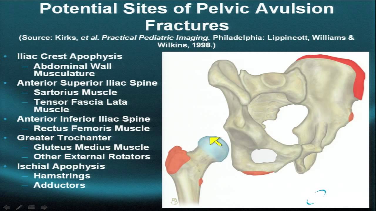 MRI Online: Hip Imaging, Part XII
