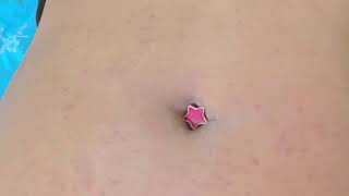 Navel Play Continues