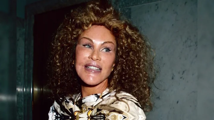 Jocelyn Wildenstein's Transformation Is A Must-See