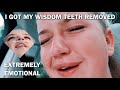 I Got My Wisdom Teeth Removed // VERY EMOTIONAL