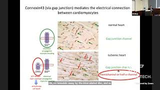 Connexin 43: A New Player in Duchenne Muscular Dystrophy and Associated Cardiomyopathy