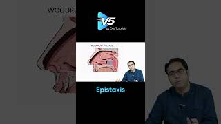 Understanding Epistaxis: Key Sites and Anatomy You Need to Know