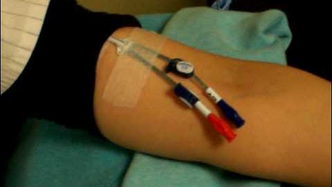 Troubleshooting your PICC line