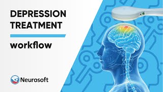 rTMS Depression Treatment Workflow screenshot 2