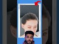 Um Erro Custou Seu Olho 😳 1080p