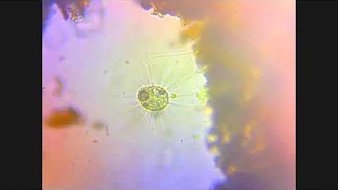 солнечник (heliozoa)