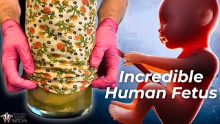 The Human Fetus That Continues to Teach Millions