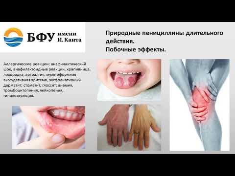Природные и полусинтетические пенициллины. Макролиды