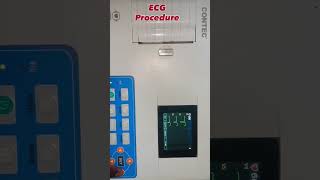 ECG......🩻