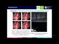 Compressive spectral acquisition system design based on deep learning