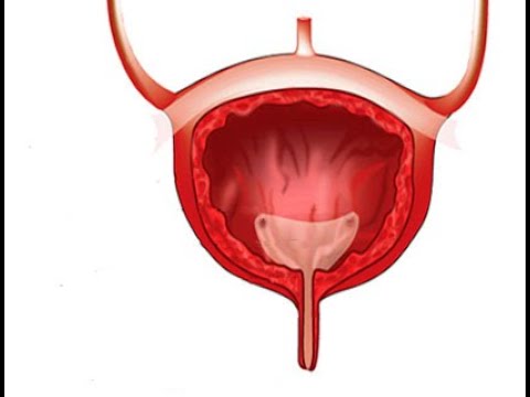 Видео: Орган ли е пикочният мехур?