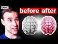 The best type of exercise to heal your brain  the brain professor