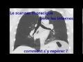 Les bronches en scanner pour les internes