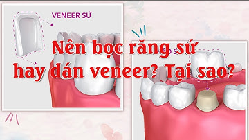 Nên bọc răng sứ hay dán veneer?