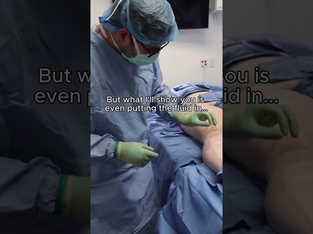 Lipedema nodules can form all over the body, causing pain and limiting movement, but they don’t have