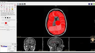 Analyze 14.0 - Segment: Freehand Draw 2D Region Definition