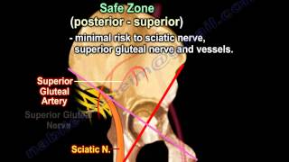 Total Hip Acetabular Screw Placement - Everything You Need To Know - Dr. Nabil Ebraheim