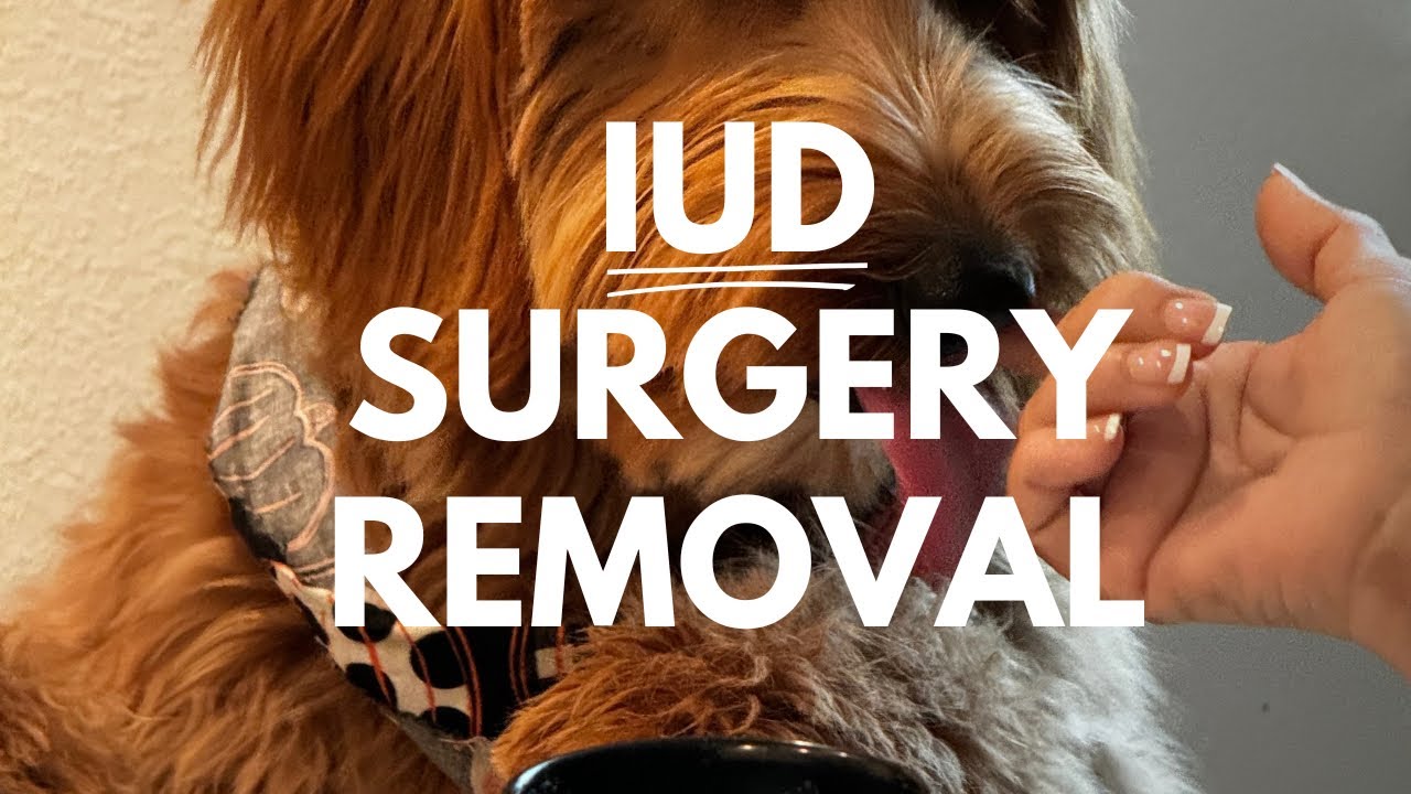 PARAGARD IUD REMOVAL EXPERIENCE !!!