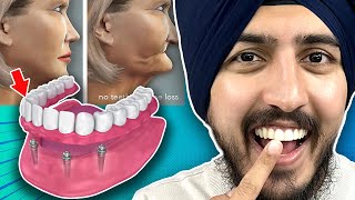 Watch This BEFORE Getting A Denture Or Partial Denture