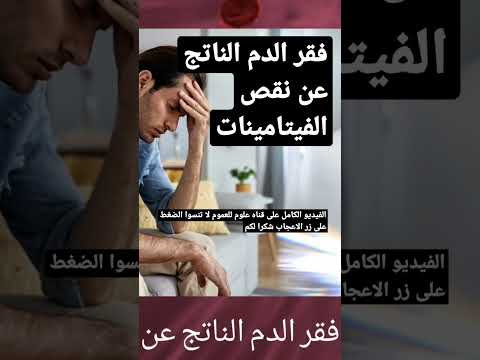 فقر الدم الناتج عن نقص الفيتامينات صحة فقر الدم