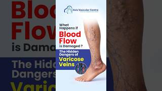 What Happens if Blood Flow is Damaged ? | Dr. Rajah V Koppala | Avis Hospitals