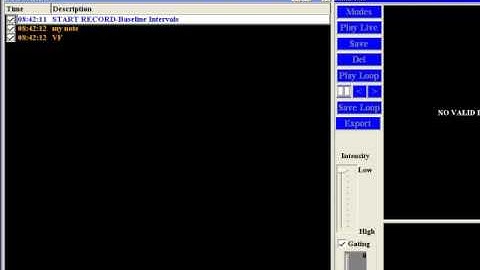 EP WorkMate™ Recording System Training  Module 9   St  Jude Medical