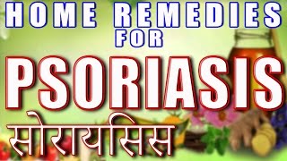 Home Remedies for Psoriasis II सोराइसिस के घरेलु उपचार II