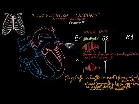 Vidéo: Comment diagnostiquer un souffle cardiaque : 13 étapes (avec photos)