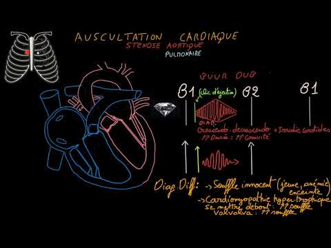 Vidéo: Les artères carotides devraient-elles avoir du bruit ?