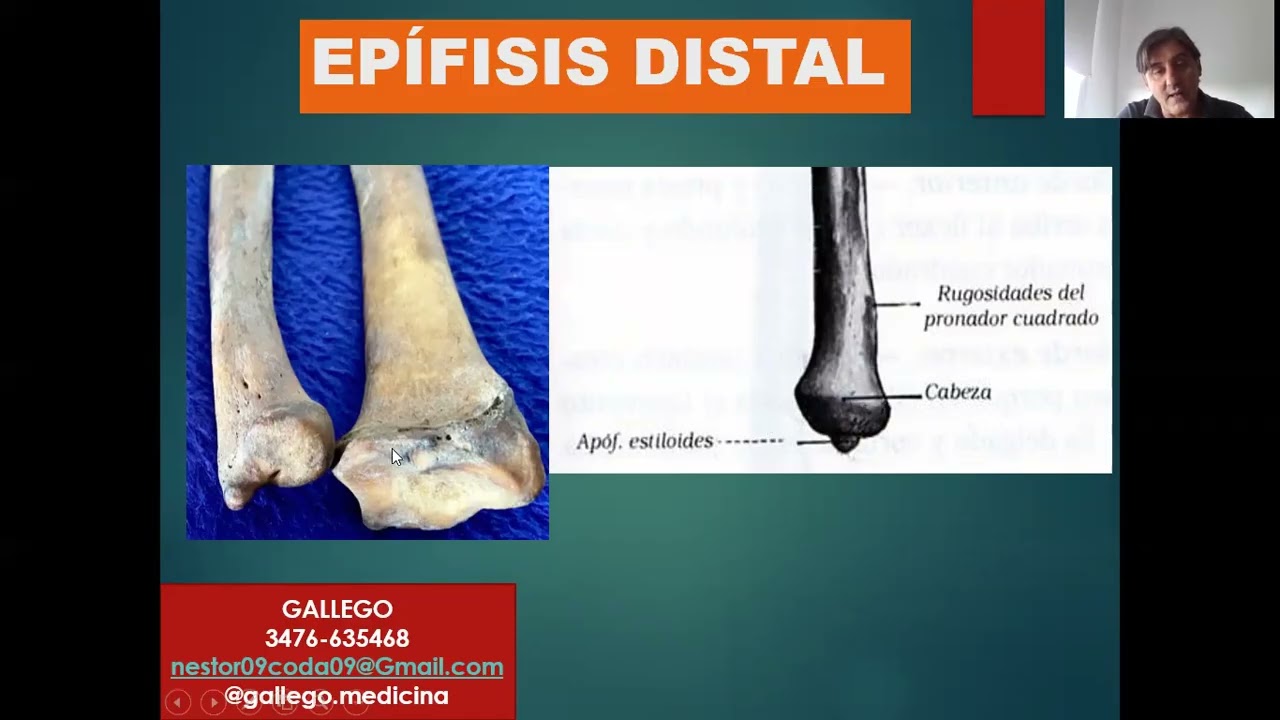 ANATOMIA. HUESOS DEL ANTEBRAZO, RADIO, CÚBITO (ULNAR)