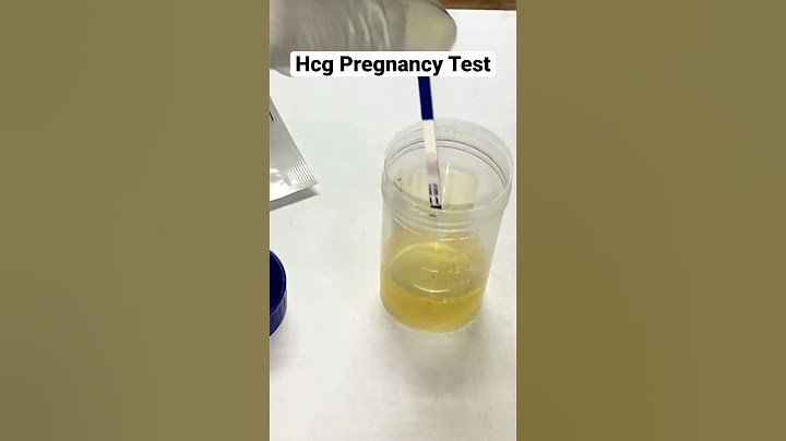 Hcg Pregnancy Test #shorts