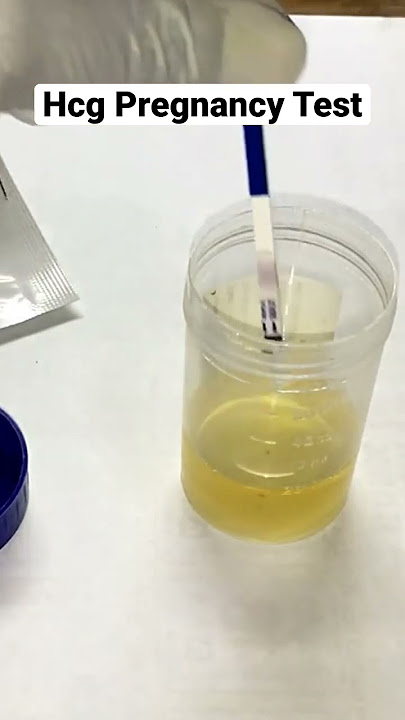 Hcg Pregnancy Test #shorts