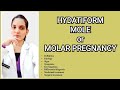 Hydatidiform moleobstetrics explained with notesmolar pregnancy dr deeksha