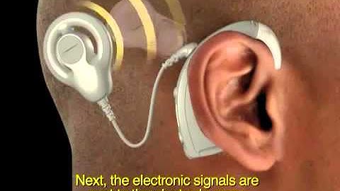 How the Nucleus Freedom system works