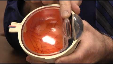 How Vision Works Richie Eye Basics REC MN