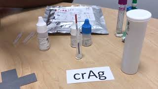 Minimum Package of Diagnostics for Advanced HIV: CD4, TB LAM, and CrAg