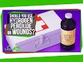 Should You Use Hydrogen Peroxide to Clean Wounds?