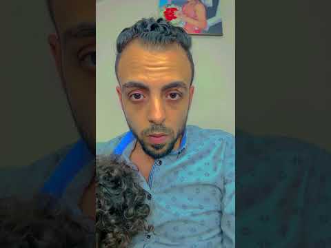 هههههههه كريس كومنتير  كرستيانو  كوميديات اكسبلور البنكرياس