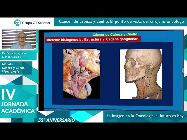 Cáncer de cabeza y cuello. El punto de vista del cirujano oncólogo